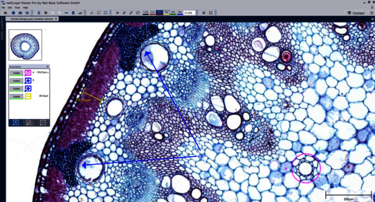 netScope Viewer annotations screenschot